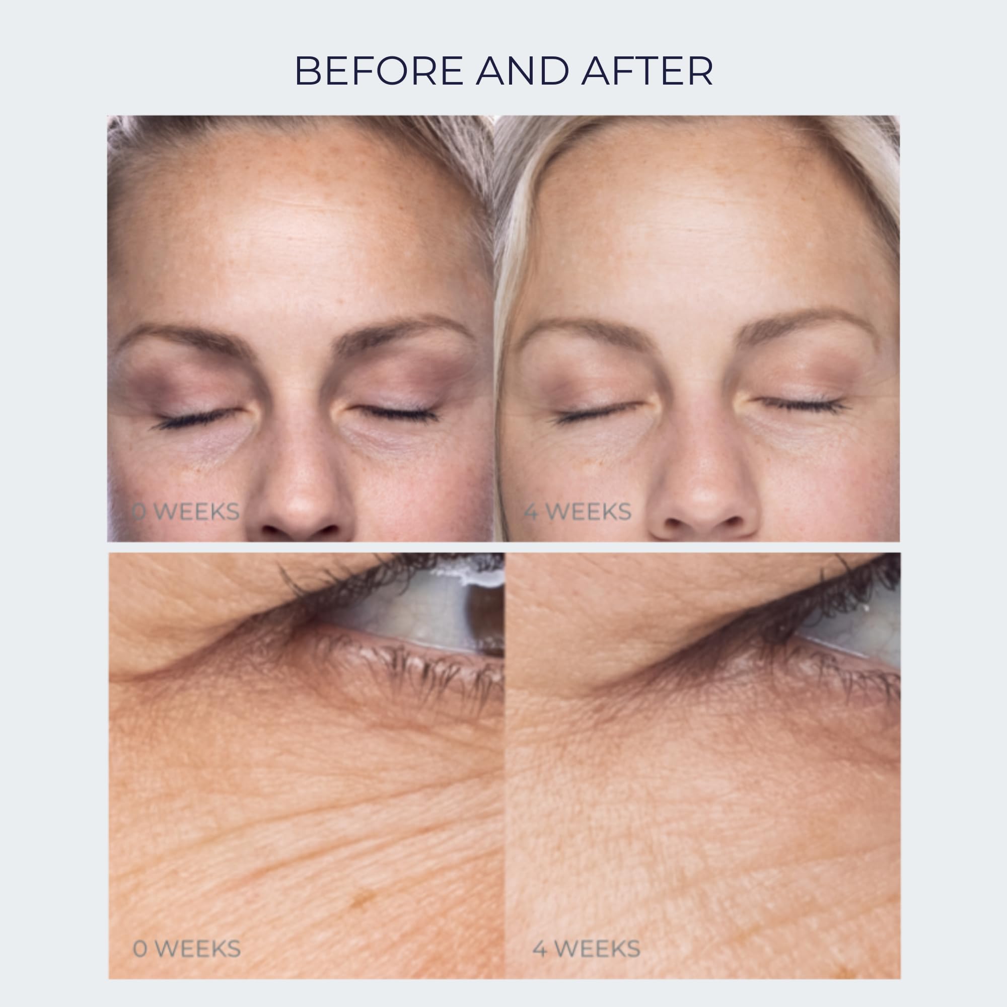 Anti-Aging Firming Peptide Eye Cream By Alana Mitchell - Look Younger, Reduce Wrinkles, Diminish Fine Lines & Erase Crow’s Feet - Deep Hydration & Nourishing - For Day & Night Use - Non Greasy .5oz